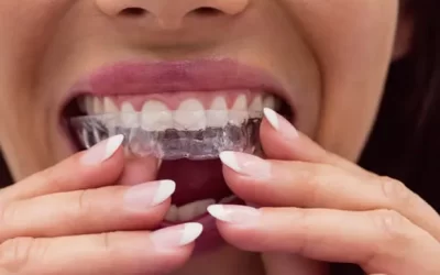 Invisalign Boston: Clear Aligner Therapy for Discreet Orthodontic Correction